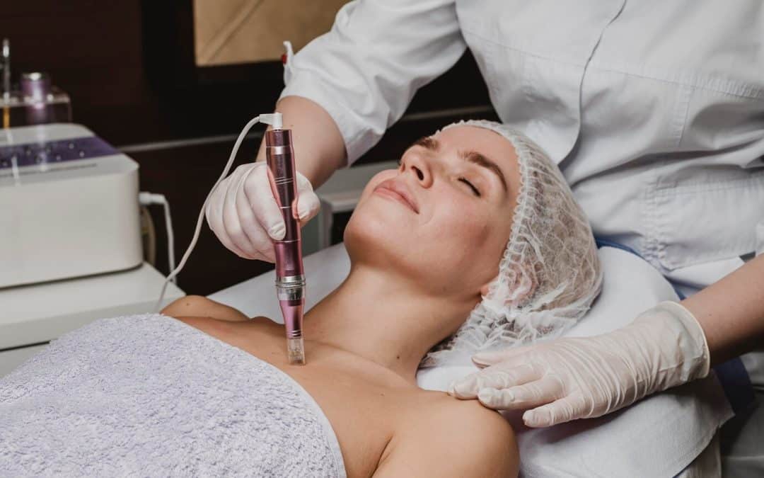 What Happens to Your Skin After Body Microneedling? Prepare to Be Amazed!